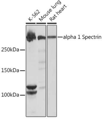 Western Blot: Spectrin alpha 1 Antibody (1U5K4) [NBP3-16833]