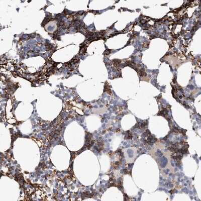 Immunohistochemistry-Paraffin: Spectrin alpha 1 Antibody [NBP1-87953]