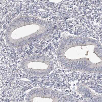 Immunohistochemistry-Paraffin: Spectrin alpha 1 Antibody [NBP1-87953]