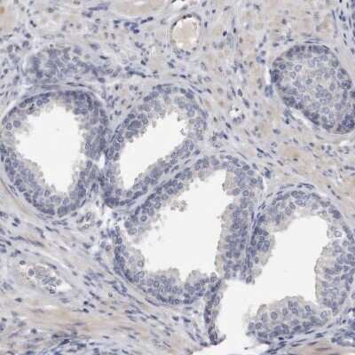 Immunohistochemistry-Paraffin: Spectrin alpha 1 Antibody [NBP1-87953]