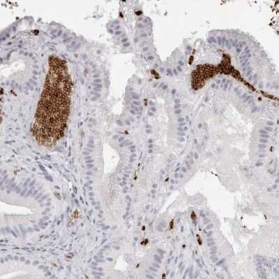 Immunohistochemistry-Paraffin: Spectrin alpha 1 Antibody [NBP2-33911]