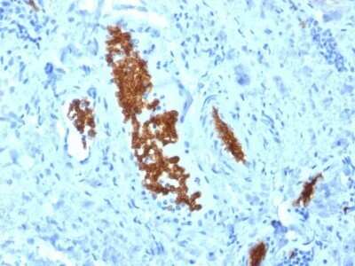 Immunohistochemistry-Paraffin: Spectrin alpha 1 Antibody (SPTA1/1810) - Azide and BSA Free [NBP2-79860]