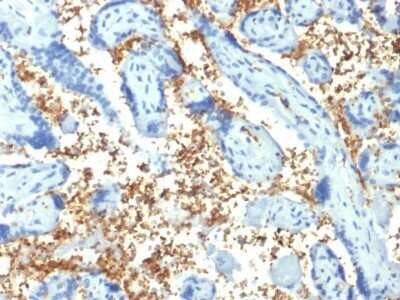 Immunohistochemistry-Paraffin: Spectrin alpha 1 Antibody (SPTA1/1810) - Azide and BSA Free [NBP2-79860]