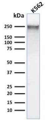 Western Blot: Spectrin alpha 1 Antibody (SPTA1/1832)Azide and BSA Free [NBP2-79906]