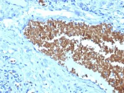 Immunohistochemistry-Paraffin: Spectrin alpha 1 Antibody (SPTA1/1832) [NBP2-79772]