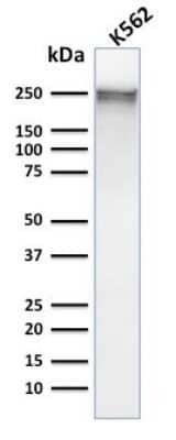 Western Blot: Spectrin alpha 1 Antibody (SPTA1/1832) [NBP2-79772]