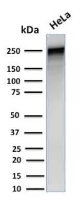 Western Blot: Spectrin alpha 1 Antibody (SPTA1/1832) [NBP2-79772]