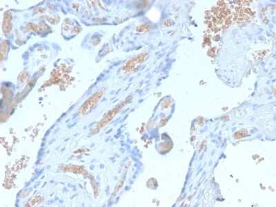 Immunohistochemistry-Paraffin: Spectrin alpha 1 Antibody (SPTA1/2939R) - Azide and BSA Free [NBP3-08346]