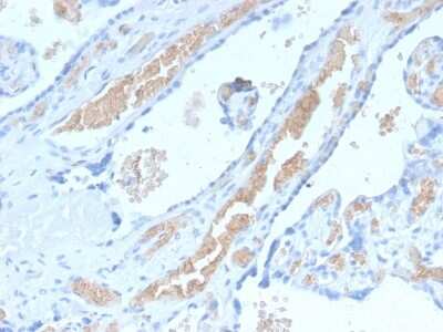 Immunohistochemistry-Paraffin: Spectrin alpha 1 Antibody (SPTA1/2939R) - Azide and BSA Free [NBP3-08346]
