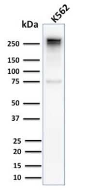 Western Blot: Spectrin alpha 1 Antibody (SPTA1/2939R) [NBP3-07265]