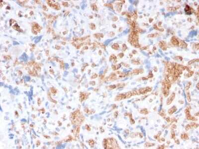 Immunohistochemistry-Paraffin: Spectrin alpha 1 Antibody (rSPTA1/1832) - Azide and BSA Free [NBP3-08317]