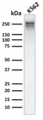 Western Blot: Spectrin alpha 1 Antibody (rSPTA1/1832)Azide and BSA Free [NBP3-08317]