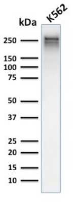 Western Blot: Spectrin alpha 1 Antibody (rSPTA1/1832) [NBP3-07855]