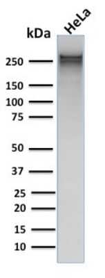 Western Blot: Spectrin alpha 1 Antibody (rSPTA1/1832) [NBP3-07855]