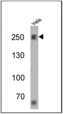 Western Blot: Spectrin beta 1 Antibody (4C3) [NB300-574]