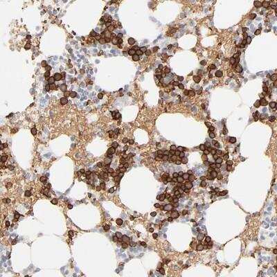 Immunohistochemistry: Spectrin beta 1 Antibody [NBP1-87596]
