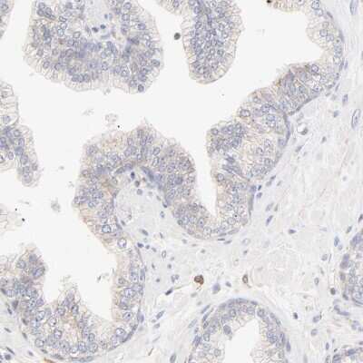 Immunohistochemistry-Paraffin: Spectrin beta 1 Antibody [NBP1-87596]