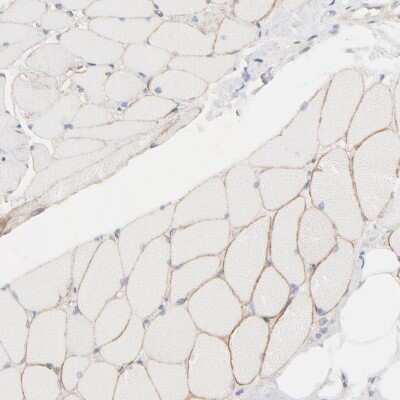 Immunohistochemistry-Paraffin: Spectrin beta 1 Antibody [NBP1-87596]