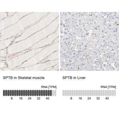 Immunohistochemistry-Paraffin: Spectrin beta 1 Antibody [NBP1-87596]
