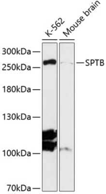 Western Blot: Spectrin beta 1 AntibodyAzide and BSA Free [NBP2-94242]