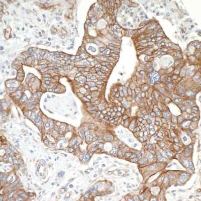 Immunohistochemistry: Spectrin beta 2 Antibody [NB100-40828]