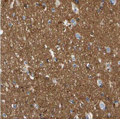 Immunohistochemistry-Paraffin: Spectrin beta 2 Antibody [NBP1-86088]