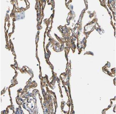 Immunohistochemistry-Paraffin: Spectrin beta 2 Antibody [NBP1-86088]