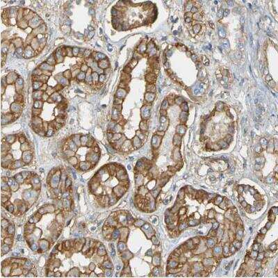 Immunohistochemistry-Paraffin: Spectrin beta 2 Antibody [NBP1-86088]