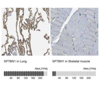 Immunohistochemistry-Paraffin: Spectrin beta 2 Antibody [NBP1-86088]