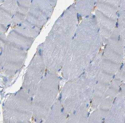 Immunohistochemistry-Paraffin: Spectrin beta 2 Antibody [NBP1-86088]