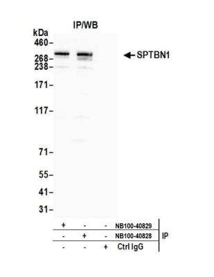 Immunoprecipitation: Spectrin beta 2 Antibody [NB100-40828]