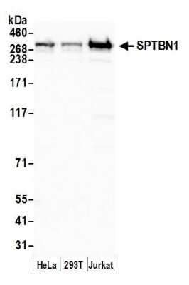 Western Blot: Spectrin beta 2 Antibody [NB100-40828]