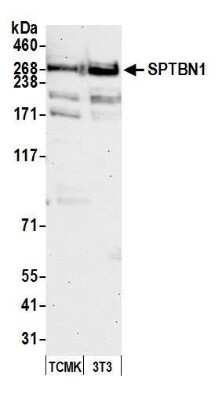 Western Blot: Spectrin beta 2 Antibody [NB100-40828]