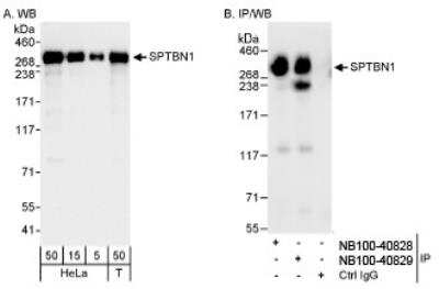 Western Blot: Spectrin beta 2 Antibody [NB100-40829]