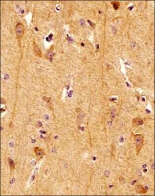 Immunohistochemistry: Spectrin beta 3 Antibody (1287A) - Azide and BSA Free [NBP2-80958]