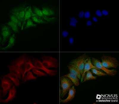 Immunocytochemistry/ Immunofluorescence: Spectrin beta 3 Antibody (1287A) - Azide and BSA Free [NBP2-59668]