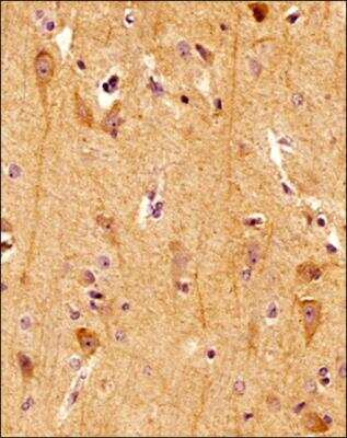 Immunohistochemistry-Paraffin: Spectrin beta 3 Antibody (1287A) - Azide and BSA Free [NBP2-59668]