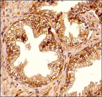 Immunohistochemistry-Paraffin: Spectrin beta 3 Antibody (3B1NB) - Azide Free [NBP2-44311]