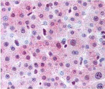 Immunohistochemistry: Spectrin beta 3 Antibody [NB110-58783]