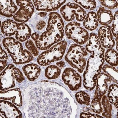 Immunohistochemistry: Spectrin beta 3 Antibody [NBP2-48794]