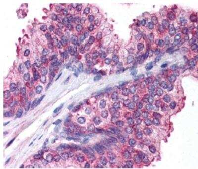 Immunohistochemistry-Paraffin: Spectrin beta 3 Antibody - BSA Free [NB110-58346]