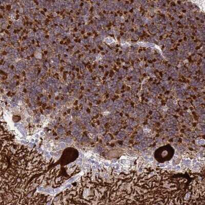 Immunohistochemistry-Paraffin: Spectrin beta 3 Antibody [NBP2-48703]