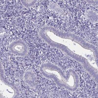 Immunohistochemistry-Paraffin: Spectrin beta 3 Antibody [NBP2-48703]