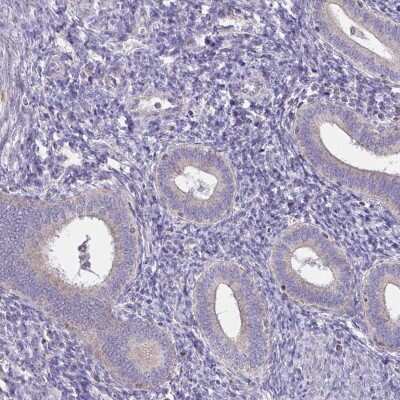 Immunohistochemistry-Paraffin: Spectrin beta 3 Antibody [NBP2-48794]