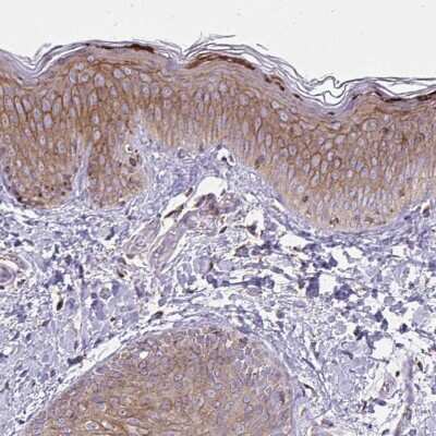 Immunohistochemistry-Paraffin: Spectrin beta 3 Antibody [NBP2-48794]