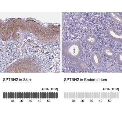 Immunohistochemistry-Paraffin: Spectrin beta 3 Antibody [NBP2-48794]