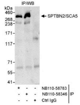 Immunoprecipitation: Spectrin beta 3 Antibody [NB110-58783]
