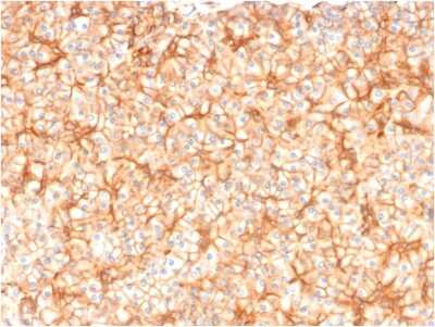 Immunohistochemistry-Paraffin: Spectrin beta 3 Antibody (SPTBN2/1582) [NBP2-53236]