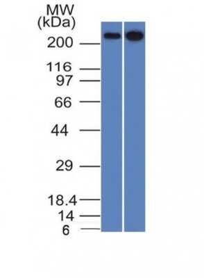 Western Blot: Spectrin beta 3 Antibody (SPTBN2/1582) [NBP2-53236]