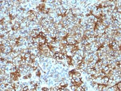Immunohistochemistry-Paraffin: Spectrin beta 3 Antibody (SPTBN2/1583) [NBP2-53312]